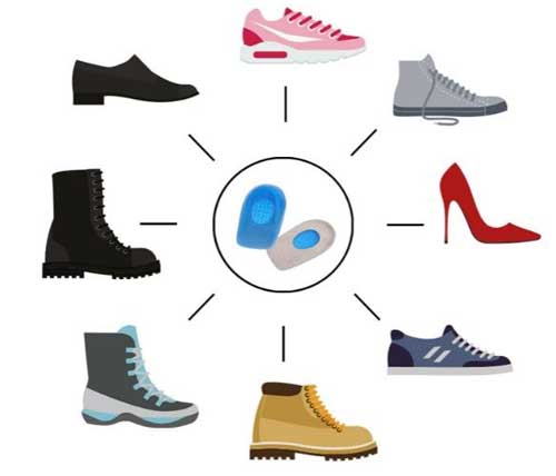 jedinstvene gel štikle